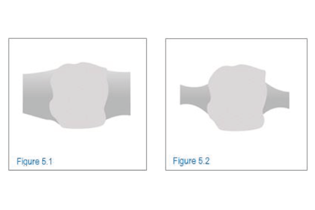 Illustration that compares bond posts on a standard vitrified wheel and a stronger bond that results in thinner bond posts