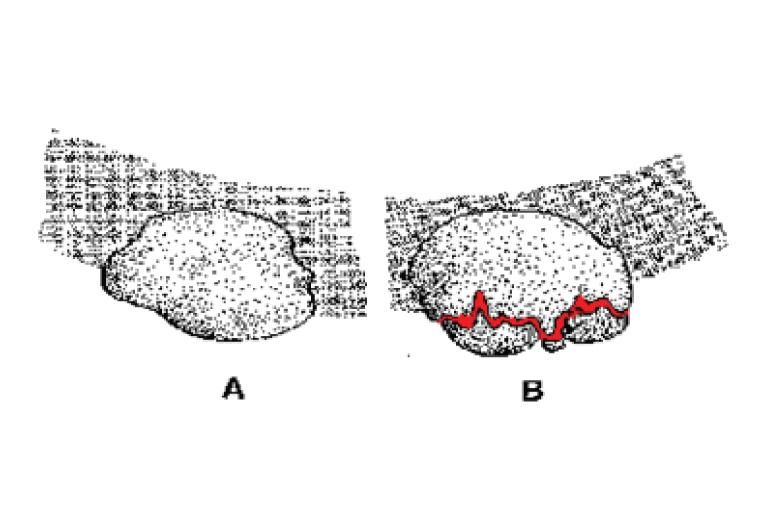 Grain fracturing to create new cutting surfaces and release the metal chip